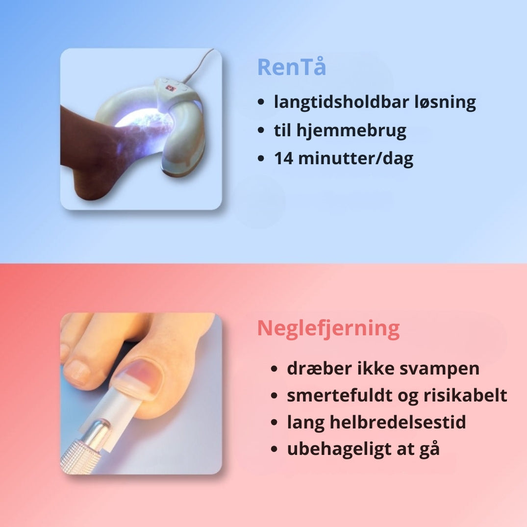 RenTå | Slip af med neglesvamp hurtigt og smertefrit