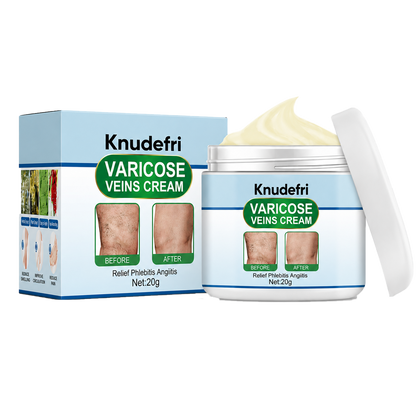 Knudefri Krampebalsam | 92% Mindre Synlige Årer På 7 Dage