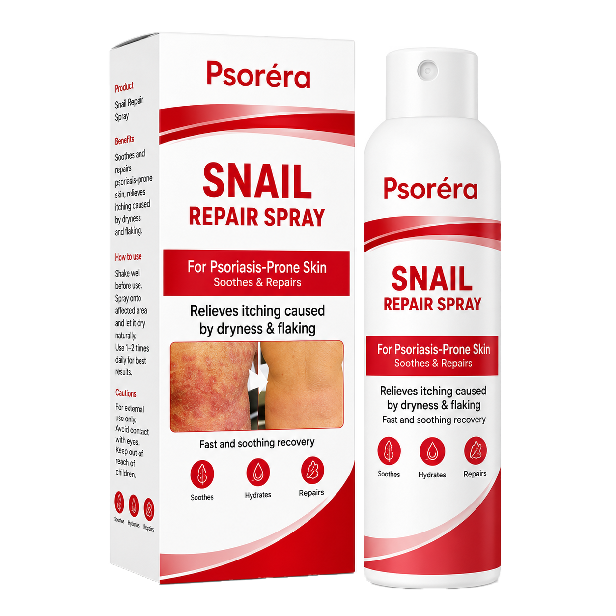 Psoréra | Lindrer Psoriasisudbrud Inden For 5 Dage — Uden Dyre Dermatologbesøg