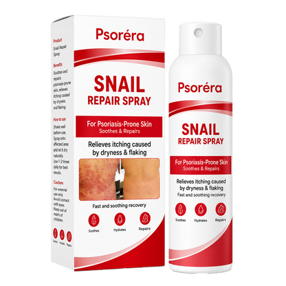 Psoréra | Lindrer Psoriasisudbrud Inden For 5 Dage — Uden Dyre Dermatologbesøg
