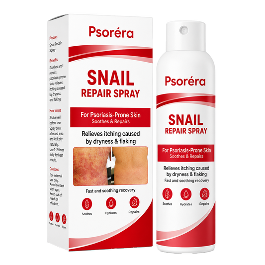 Psoréra | Lindrer Psoriasisudbrud Inden For 5 Dage — Uden Dyre Dermatologbesøg