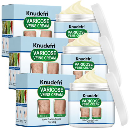 Knudefri Krampebalsam | 92% Mindre Synlige Årer På 7 Dage
