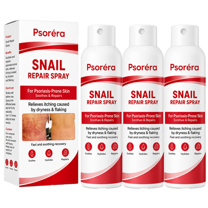 Psoréra | Lindrer Psoriasisudbrud Inden For 5 Dage — Uden Dyre Dermatologbesøg